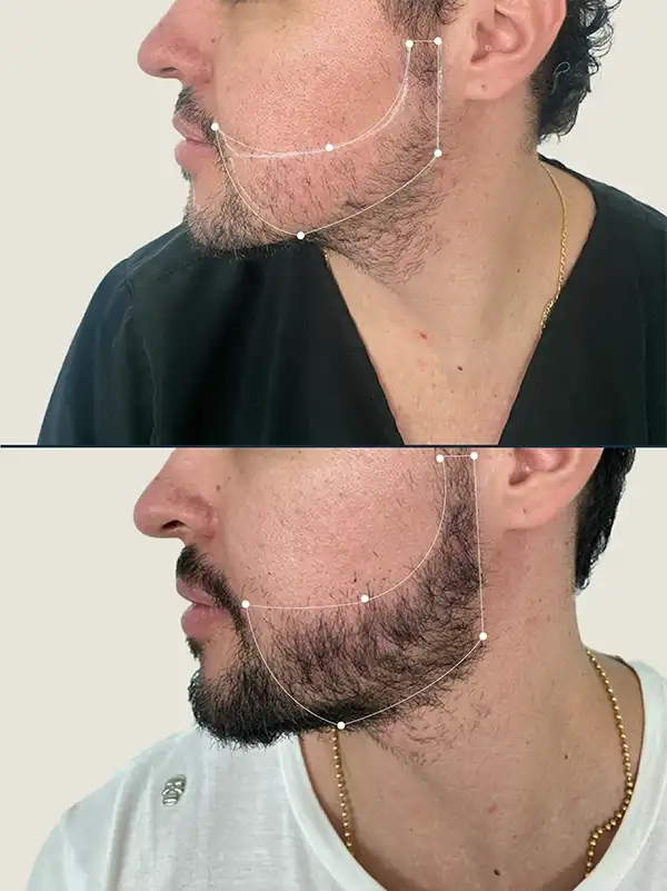 Img-Clinica_Capillare-Antes&Despues-8